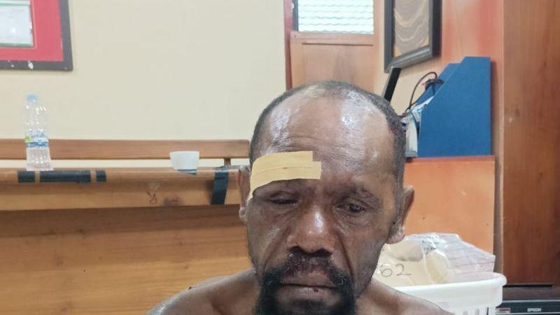 Aktor Utama Kerusuhan Yahukimo Papua Ditangkap! Begini Penampakannya