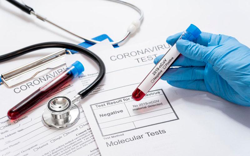 Kontak Erat Positif Omicron Tapi Hasil PCR Negatif, Tetap Perlu Isolasi 5 Hari