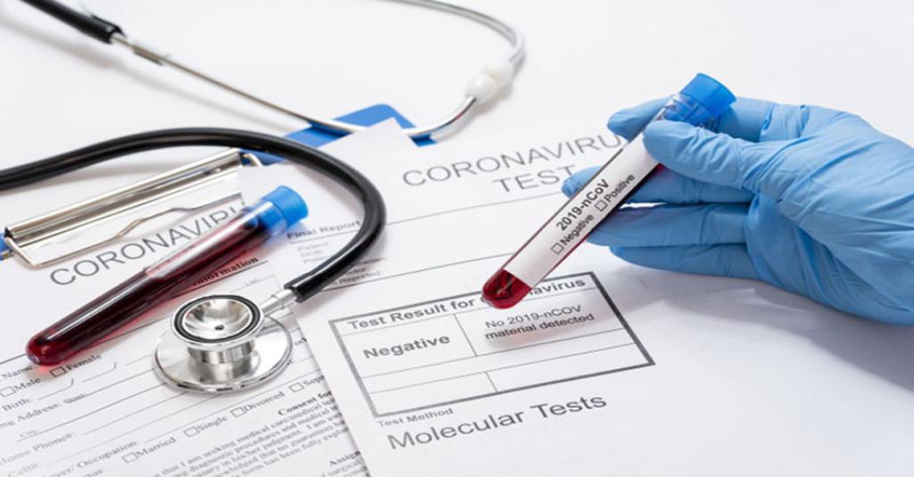 Catat! Tes PCR Jangan Berpindah-pindah Laboratorium