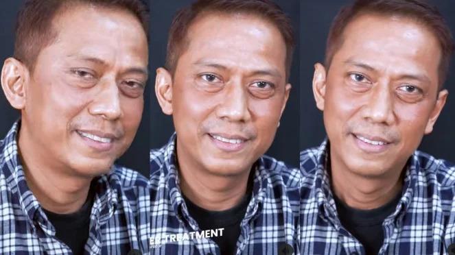 Netizen Julid, Saat Dody Sudrajat Perawatan Wajah 25 Juta