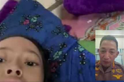 RS Polri Kerahkan Dokter Spesialis Tangani Sinta, Bocah Penderita Tumor Tulang