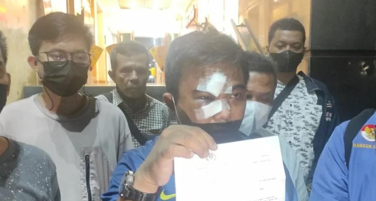 Meski Wajah Bonyok, Haris Pertama Hadir Jadi Saksi di Sidang Ferdinand Hutahaean