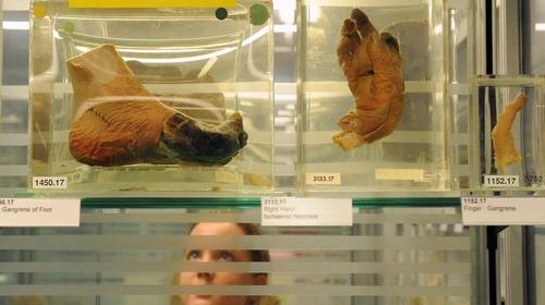 Waduh! Perancang Busana Indonesia, Pesan Organ Manusia