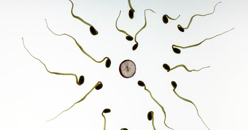 Jangan Cuma Kesuburan Wanita, Kualitas Sperma Wajib Diperhatikan untuk 'Pregnant Goals'