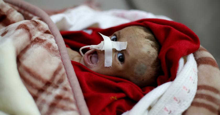 PBB Tuntut Gencatan Senjata Kemanusiaan di Yaman Guna Hindari Kelaparan