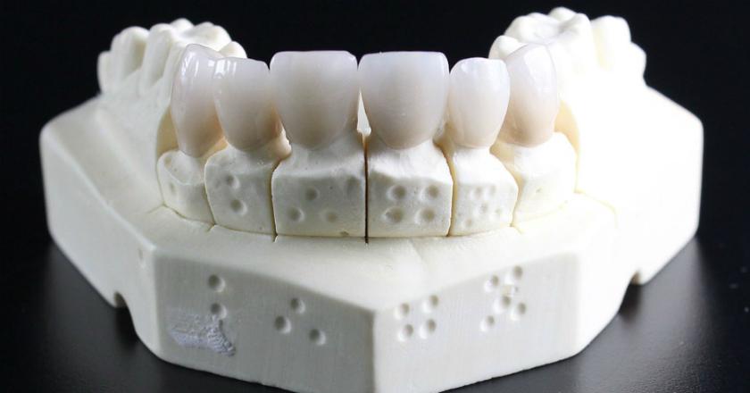 1.000 Gigi Manusia Ditemukan Tertanam Dalam Bangunan di Amerika Serikat