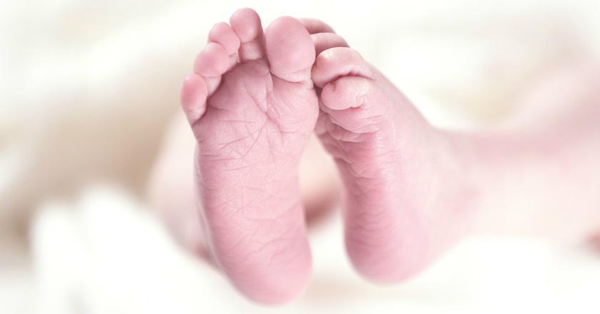 Pertama, Bayi Ini Terlahir dengan Penyakit Menular Seksual