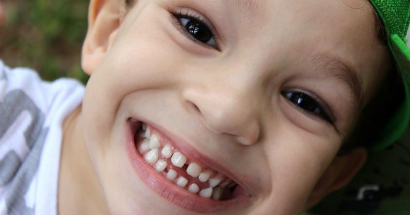 Orangtua Harus Tahu, 3 Langkah Mencegah Gigi Anak Berlubang