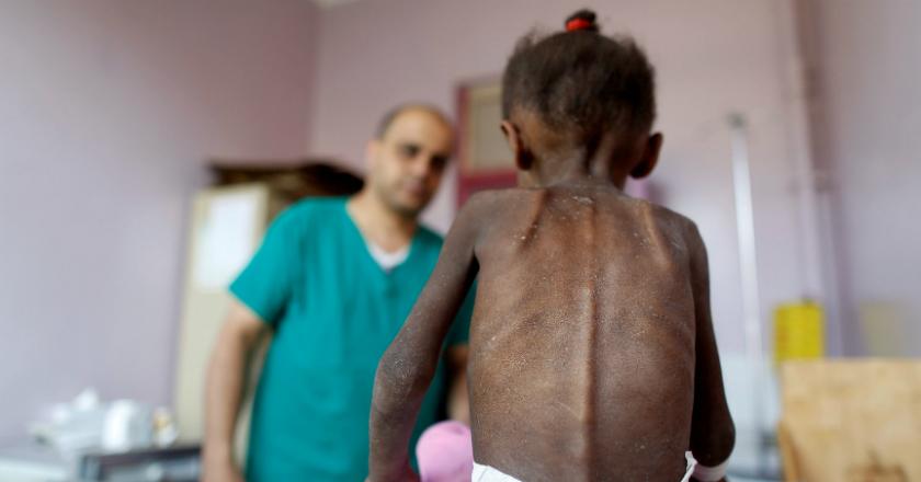 Krisis Kelaparan, PBB Berikan Bantuan Bulanan untuk 14 Juta Warga Yaman