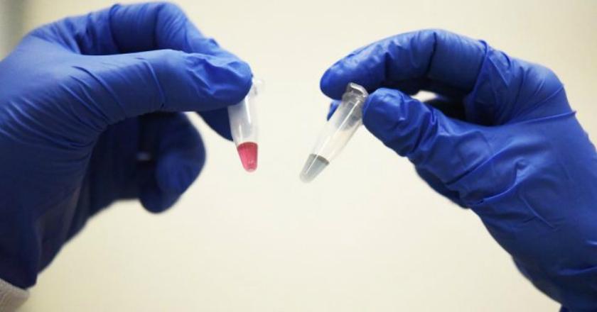 Penemuan DNA Unik Dapat Mengubah Cara Diagnosa Kanker Tahap Awal