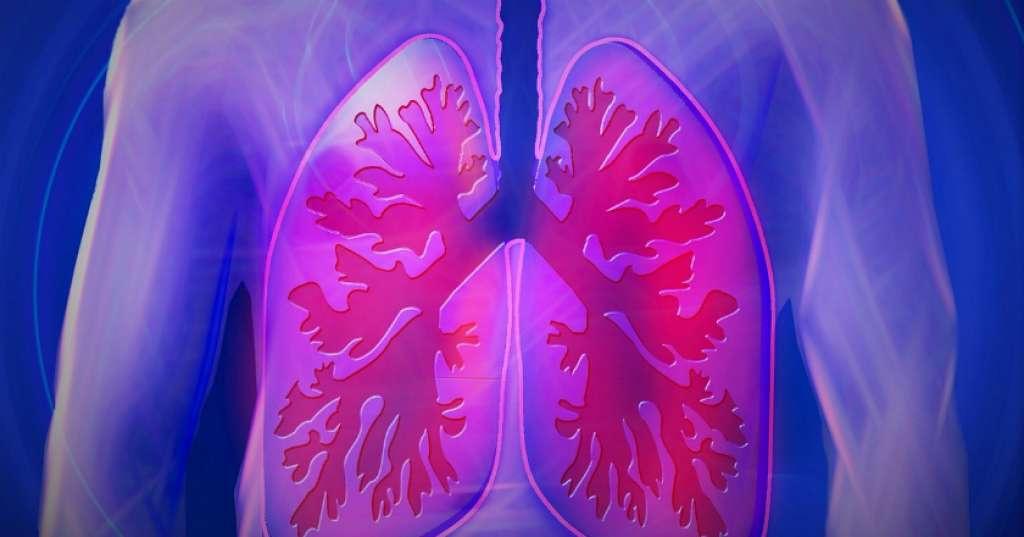 Batuk Pilek Tak Kunjung Sembuh Bisa Jadi Gejala Pneumonia