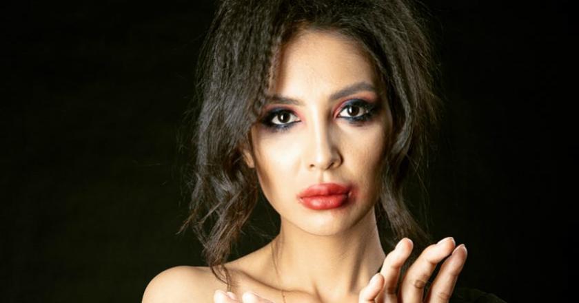 Model Cantik Asal Kazakhastan Unggah Foto Penuh Luka Lebam, Kenapa?