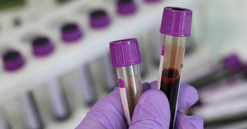 Wow! Ilmuwan Berhasil Rekayasa Umur Sel untuk Perlambat Penuaan