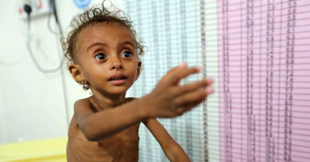 UNICEF: Jutaan Anak Tinggal di 31 Zona Konflik Aktif di Yaman
