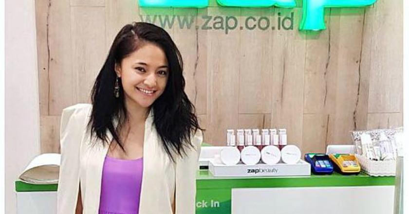 Bulu Kaki Tumbuh Lebat, Marshanda Merasa Seperti Laki-laki