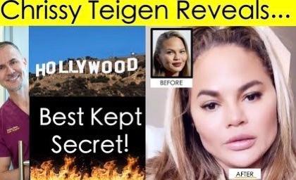 Buccal Fat Removal Jadi Tren Kecantikan Terbaru yang Bikin Pipi Tirus Alami. Begini Prosedurnya!