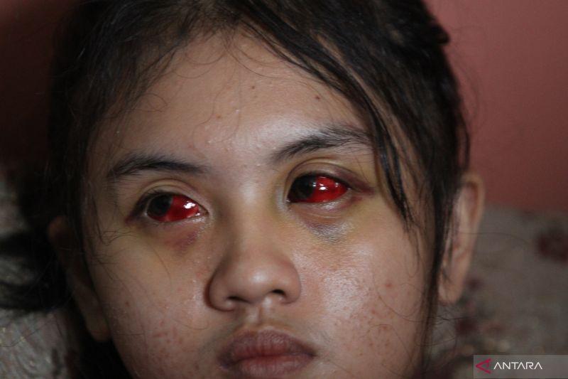 Komnas HAM Pelajari Laporan Bukti Baru Tragedi Kanjuruhan